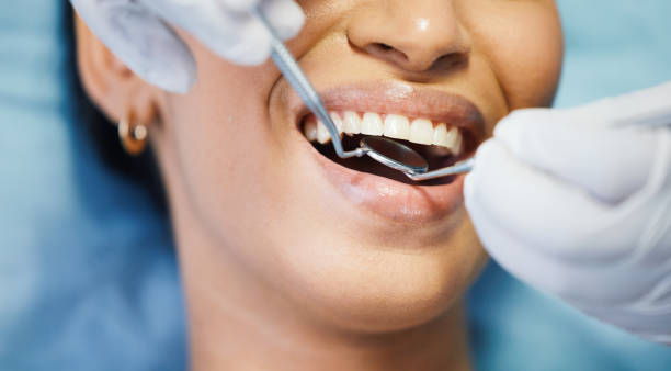 Best Emergency Treatment for Dental Infections or Abscesses in Marysville, PA