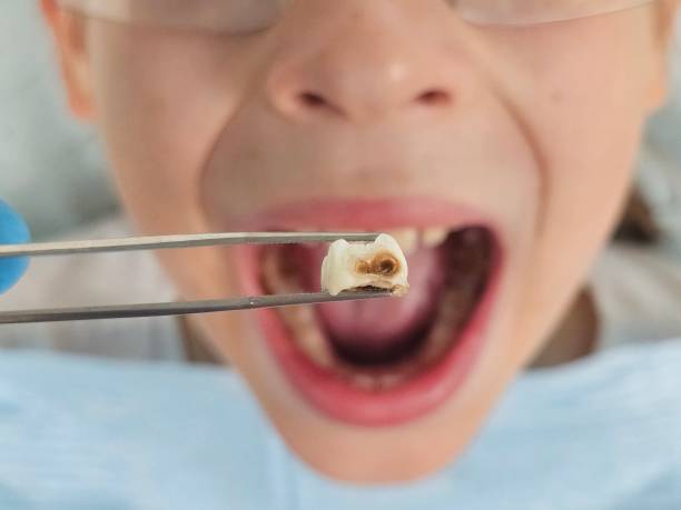 Best Weekend Emergency Dentist in Marysville, PA